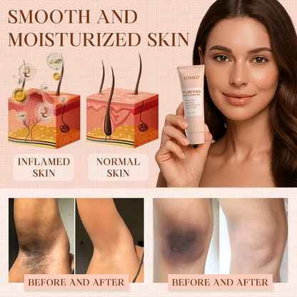 Luhaka® Purifying Exfoliating Gel for Acanthosis Nigricans, Exfoliation, Dark Spots, Skin Tags, and Eczema