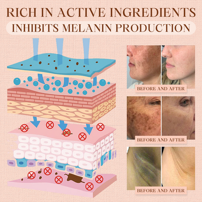 Luhaka® Purifying Exfoliating Gel for Acanthosis Nigricans, Exfoliation, Dark Spots, Skin Tags, and Eczema