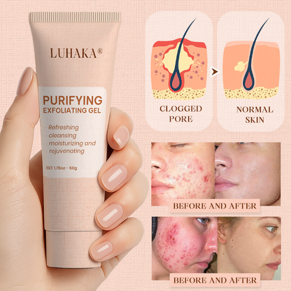 Luhaka® Purifying Exfoliating Gel for Acanthosis Nigricans, Exfoliation, Dark Spots, Skin Tags, and Eczema