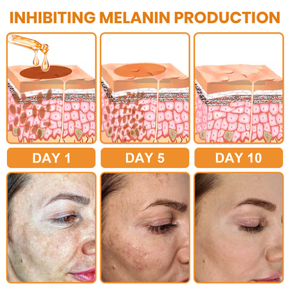 ✨Fast Dark Spot Remover-Luhaka® Melanin Correcting Facial Serum