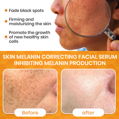 ✨Fast Dark Spot Remover-Luhaka® Melanin Correcting Facial Serum