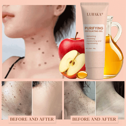 Luhaka® Purifying Exfoliating Gel for Acanthosis Nigricans, Exfoliation, Dark Spots, Skin Tags, and Eczema