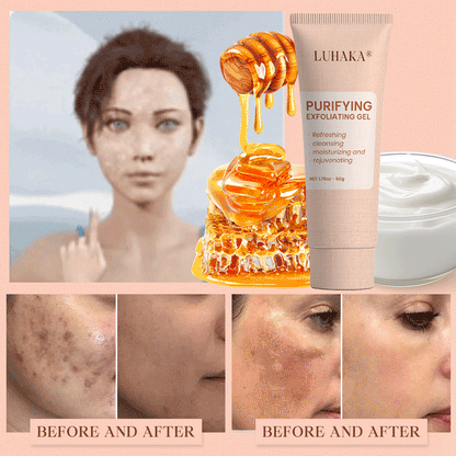Luhaka® Purifying Exfoliating Gel for Acanthosis Nigricans, Exfoliation, Dark Spots, Skin Tags, and Eczema